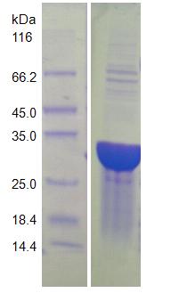 15 % SDS-PAGE analysis of purified HIV-1 reverse transcriptase